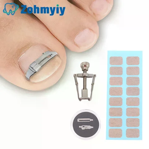 Herramientas Correctoras de Uñas Encarnadas, Tratamiento Profesional para Pedicura y Recuperación de Uñas Encarnadas, Herramienta de Cuidado y Corrección de Pies 2