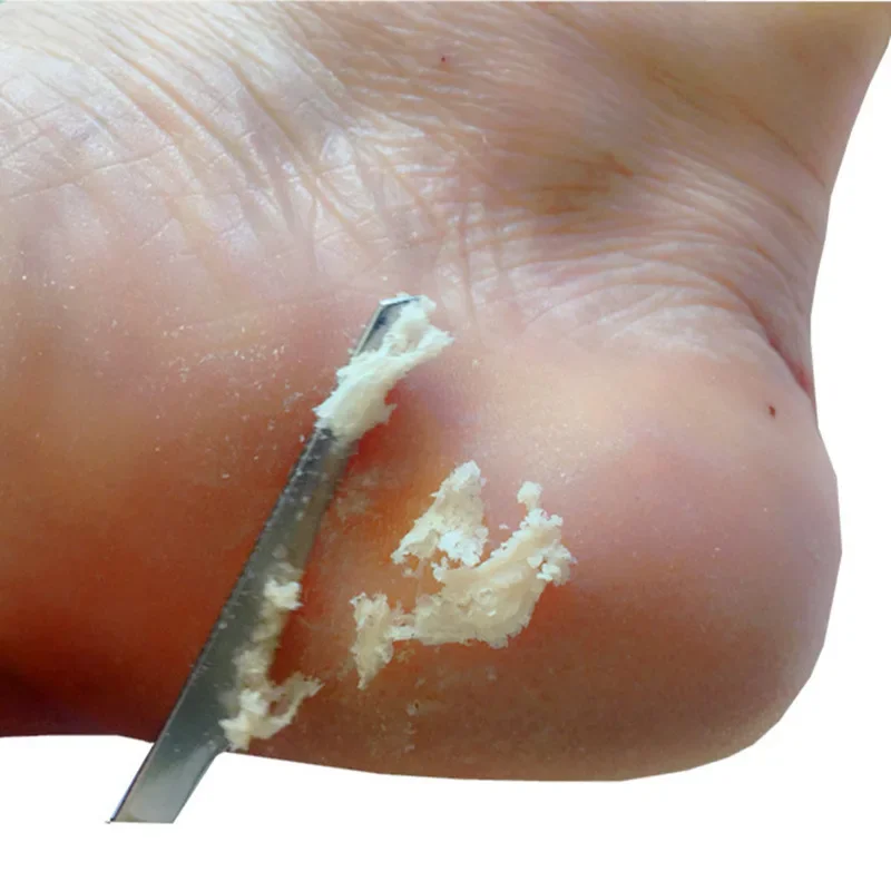 Herramientas de manicura y pedicura, afeitadora de uñas para pies, Kit de cuchillos para pedicura, Lima de escofina para callos, producto para eliminar la piel muerta, herramientas para el cuidado de los pies